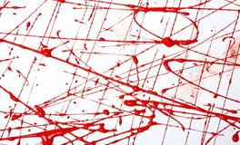 梦见手流血是什么意思